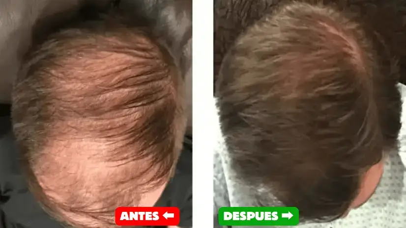 Testimonio