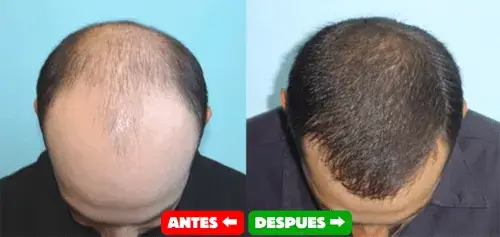 Testimonio